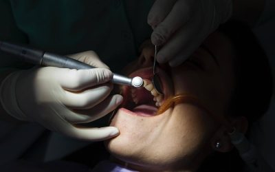 Implantología y Prótesis Dental